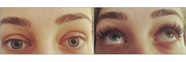 Wimpernverlängerung